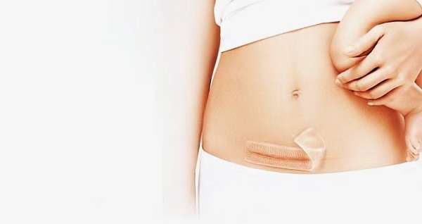 موٹی سلیکون جیل کے داغ کی چادریں اتنی مشہور کیوں ہیں؟