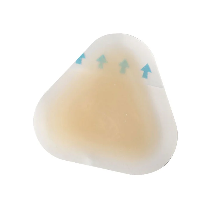 ہیلس کے لئے جراثیم سے پاک چھالے کی روک تھام